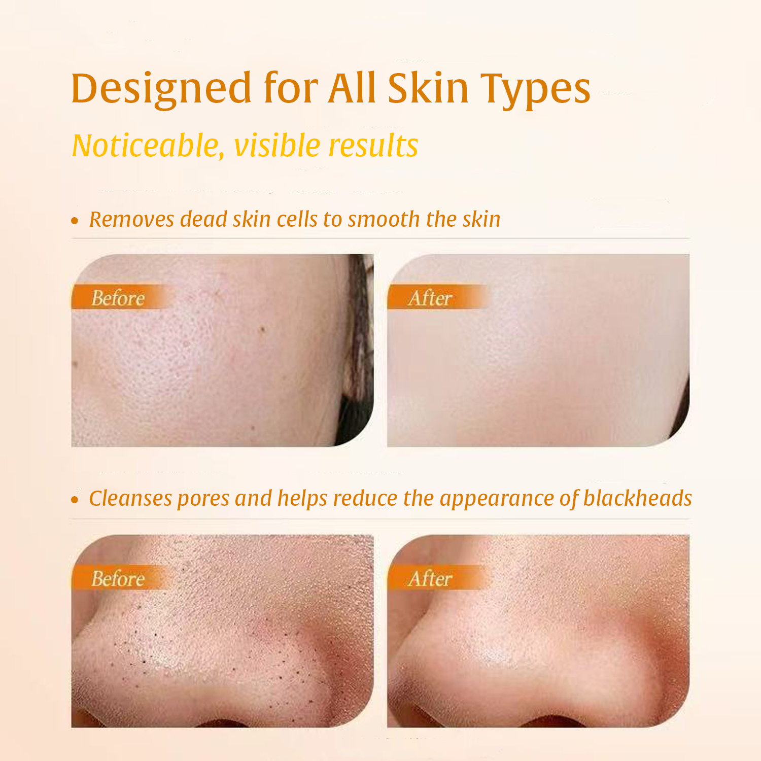Turmeric Kojic Acid Body Exfol - Aha Bha Exfoliant avis et prix