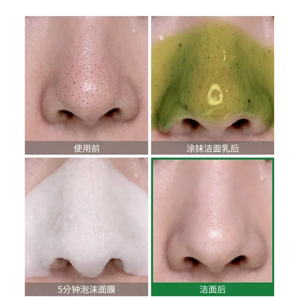 Korea SOME BY MI Bye Bye Black - Skincare Some By Mi avis et prix